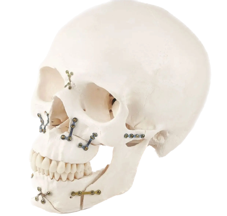 Maxillofacial surgery