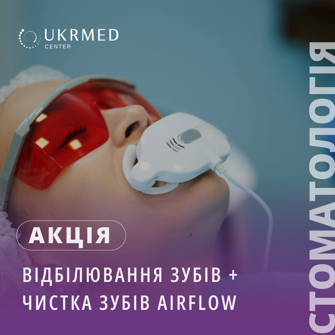 Відбілювання зубів в UKRMED